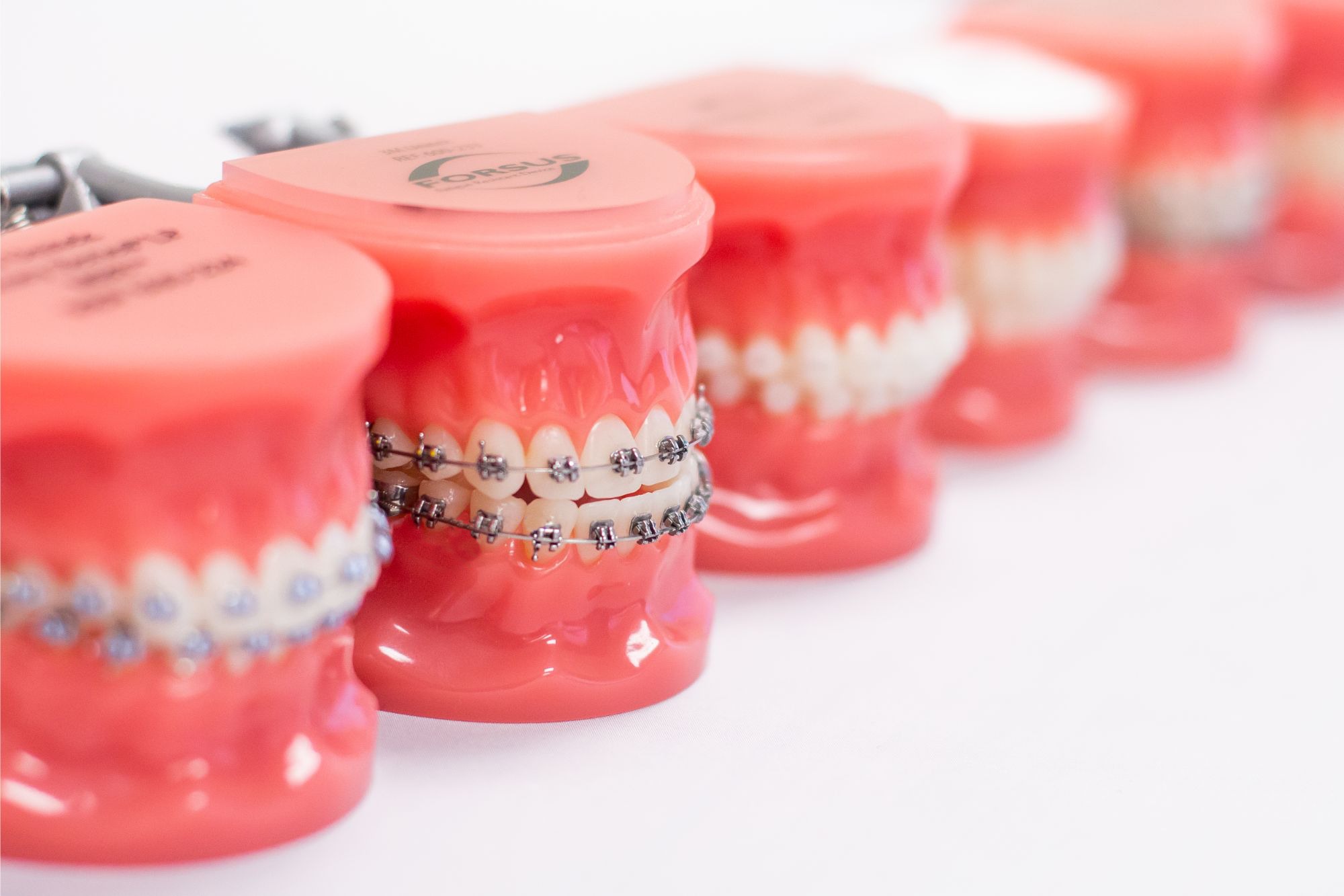Treatment Options Harville Orthodontics Invisalign Kingsport